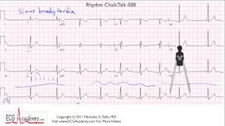 ECG Interpretation Tutorial - ChalkTalk 08 - Basic Level