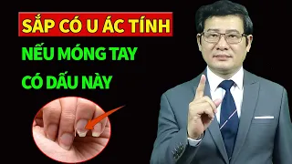 Sắp ung thư nếu móng tay xuất hiện dấu hiệu này | Sống khỏe