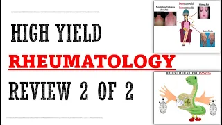 Rheumatology Part 2 of 2 Review | Mnemonics And Proven Ways To Memorize For Your Exams!