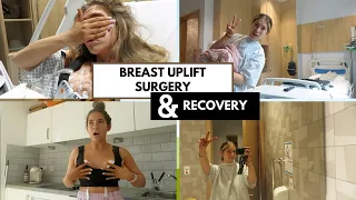 MY BREAST UPLIFT SURGERY AND RECOVERY (MASTOPEXY)