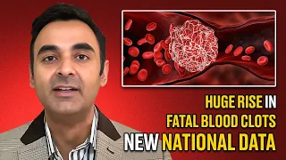Huge rise in fatal Blood Clots: New National Data