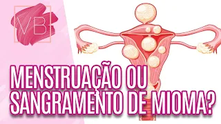 Diferença entre MENSTRUAÇÃO e SANGRAMENTO DE MIOMA - Você Bonita (28/09/2023)