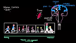 Khan Academy - Types of Cerebral Palsy Part 1: Spastic