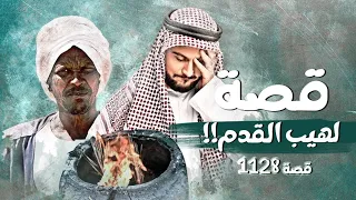 1128 - قصة لهيب القدم!!