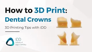 Step-By-Step Guide: How to 3D Print Dental Crowns using SprintRay Pro 55S | iDD