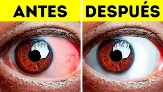 10+ Ejercicios fáciles para aliviar el cansancio de los ojos