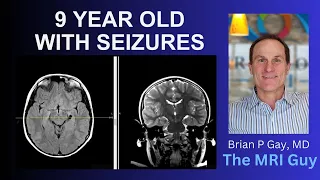 9 year old with seizures