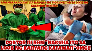 Ang NAKAKAGULAT na NAKUHA ng mga Doktor sa katawan ni Kris Aquino!!OMG!!