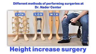 You can see height increase surgery methods at Dr. Nader center