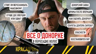 Все о донорской части при пересадке волос! Стоит ли пересаживать максимум? Две операции или одна?