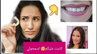 اسمحولي كذبت عليكم🥺 الحقيقة الصادمة ديال اسناني 😱🤦‍♀️😫 فيديو مكنتش متوقعة ابدا نديروا