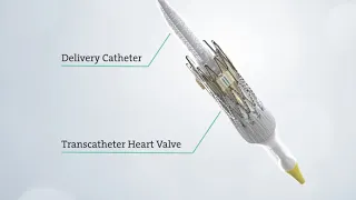 Transcatheter Aortic Valve Replacement (TAVR) - See the Procedure