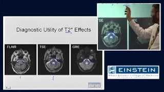 Introducing MRI: MR Imaging of Hemorrhage (52 of 56)