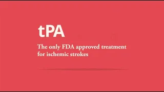 What is the stroke tPA treatment?