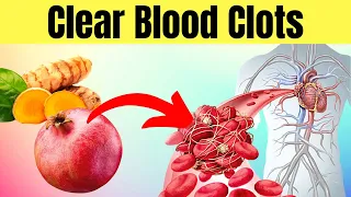 Top 13 Foods That Prevent Blood Clots and Stroke Risk