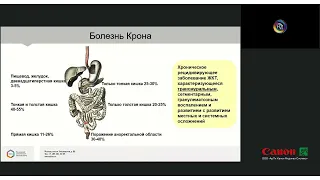 КТ энтерография в диагностике воспалительных заболеваний кишечника