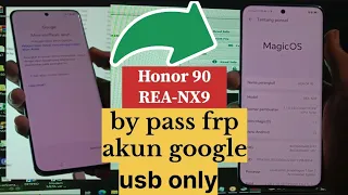 By pass frp Honor 90 (REA-NX9) lupa akun google usb only 2024