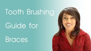 Braces Cleaning Routine | Tooth Brushing Guide for Braces