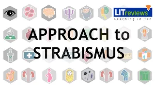 Approach to Strabismus