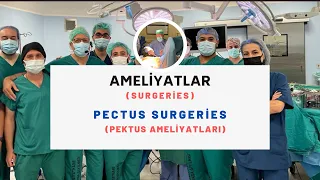 How to remove the bar in pectus excavatum after nuss operation