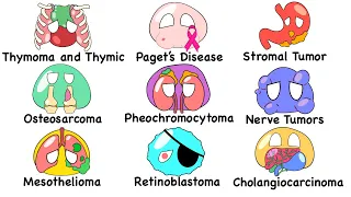 Every Rare Cancer Explained in 11 Minutes