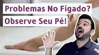 Descubra Doenças no Fígado Observando Sinais no Seu Pé | Dr. Rafael Freitas