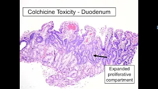 Expert Series with Elizabeth Montgomery, M.D.: Gastrointestinal #Pathology: A One-On-One Tutorial