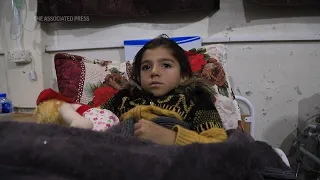 Rescued Syrian siblings receive treatment in Idlib