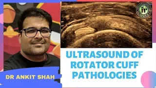 TMT: USG in Rotator Cuff Pathologies by Dr Ankit Shah