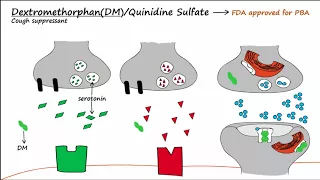 Pseudobulbar Affect (PBA) - Part 2 - Treatment