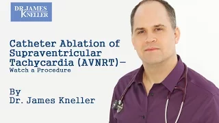 Catheter Ablation of Supraventricular Tachycardia (AVNRT) - Watch a Procedure