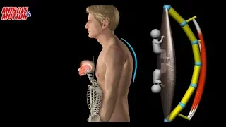 Myofacia approach for forward-head posture