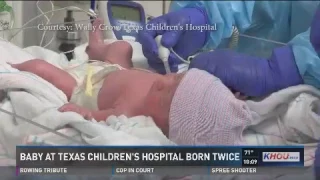 Baby born twice at Texas Children's Hospital