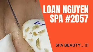 #2057 | LOAN NGUYEN SPA