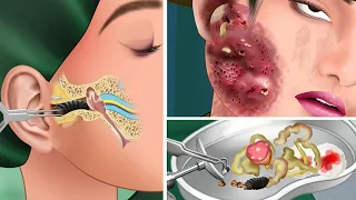 ASMR treatment infected wounds and get rid of insects in the ear - 은 감염된 상처를 치료하고 귀의 벌레를 제거합니다