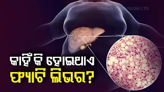 Doctor Doctor 26Th August | What Leads To Fatty Liver Problem? Dr. Ashok Kumar Choudhary