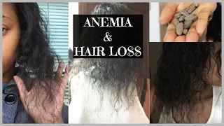 Anemia & Hair Loss: My Story and Recovery