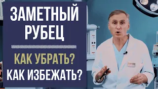 РУБЕЦ 😱 КАК УБРАТЬ ШРАМЫ, КАК ПРЕДОТВРАТИТЬ❓