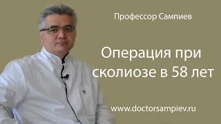 Операция при сколиозе в 58 лет // Сколиоз и возраст //История болезни Дины