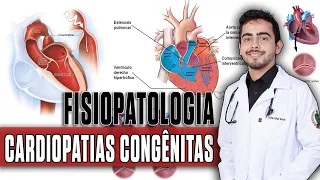 Cardiopatias Congênitas │ Fisiopatologia PORTH