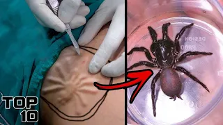 Top 10 Scary Things Secretly Living In Your BODY | Marathon