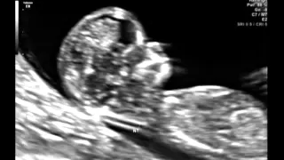 Ultrasound Video- Part One, 12 Weeks & 2 Days... It's a girl! 10/15/12