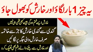 Kharish Ka ilaj | Khujli Ka ilaj | Body itching Home Remedy in Urdu/Hindi Dr Sharafat Ali New 2021