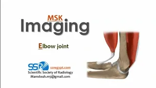 Imaging of the elbow joint (DRE) Prof. Mamdouh Mahfouz