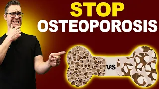 Top 7 Osteopenia & Osteoporosis Treatments! [Symptoms & Medications]