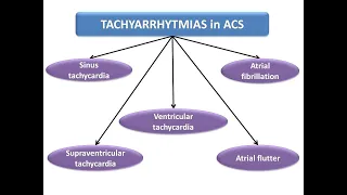 ECG course: Tachyarrhythmias with ACS, Dr. Sherif Altoukhy