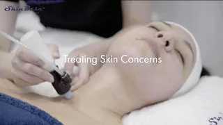 Treating skin concerns with SkinBase microdermabrasion