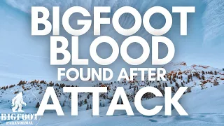 BIGFOOT Blood And Teeth Marks Found On House After Attack | Over 1 Hour SASQUATCH ENCOUNTERS PODCAST