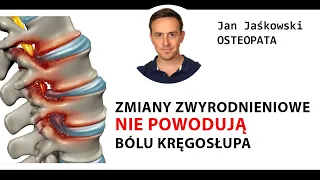 Zmiany zyrodnieniowe nie powoduja bólu kręgosłupa