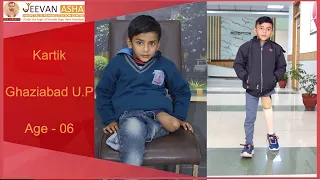 Kartik lost his left leg in an accident Jeevan Asha Hospital provided him free of cost prosthesis